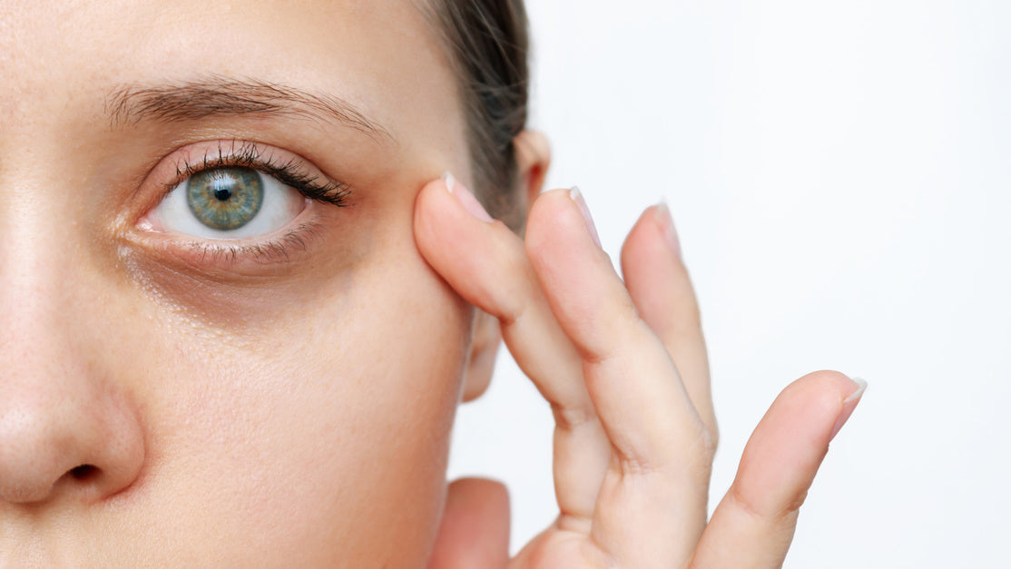red light therapy for dark circles